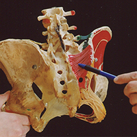 Sacrotuberous Ligament Sprains